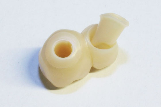 Коронки из циркония с абатментами