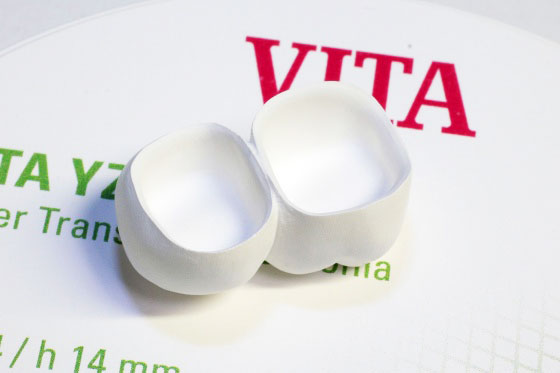 Коронки из циркония до синтеризации